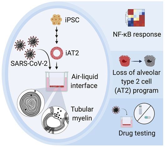 间充质干细胞在COVID-19中的应用