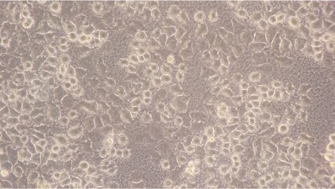 细胞状态差，我们帮您来分析~