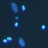 细胞凋亡Hoechst染色