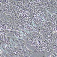 RENCA小鼠肾癌细胞丨renca细胞