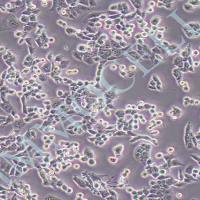 LLC小鼠Lewis肺癌细胞丨llc细胞 价格