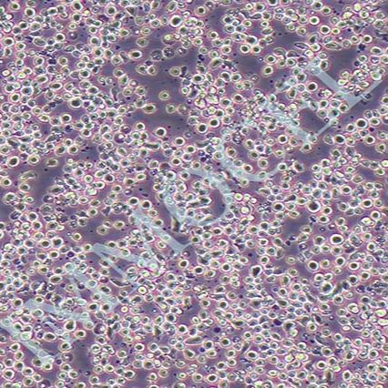 CEM/C1人急性淋巴细胞白血病细胞丨[CEM/C1]细胞