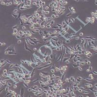 4T1 小鼠乳腺癌细胞 丨4t1细胞丨小鼠乳腺癌细胞