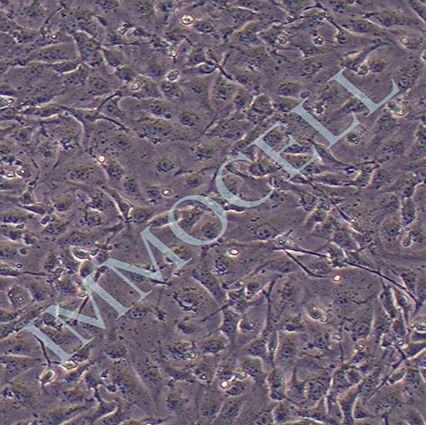 ID8小鼠卵巢上皮癌细胞丨逸漠(immocell)
