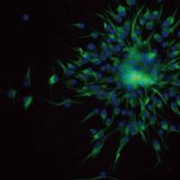 稳定细胞株筛选