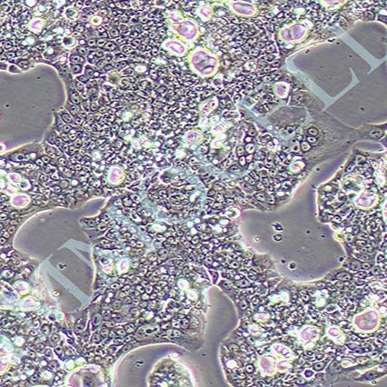 NCI-N87人胃癌细胞(含STR鉴定)丨NCI-N87细胞
