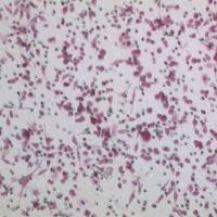 Transwell细胞侵袭