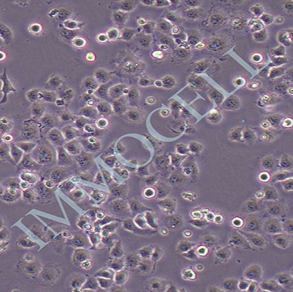 HO-8910PM人卵巢癌细胞(STR鉴定)