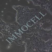 Capan-1 人胰腺癌细胞(STR鉴定)