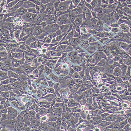 NCI-H1975人肺腺癌细胞(STR鉴定)丨NCI-H1975细胞株丨逸漠