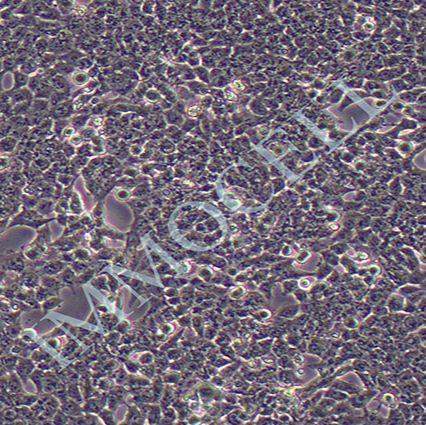 HCT-116人结肠癌细胞丨hct116细胞系 报价