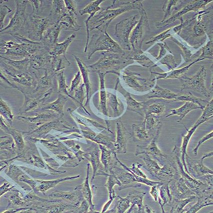 SW579人甲状腺癌细胞(STR鉴定)丨SW579细胞