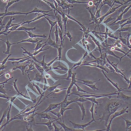 MCF-7人乳腺癌细胞(STR鉴定)丨mcf7细胞