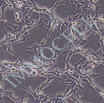 U-87MG人脑星形胶质母细胞瘤丨u87mg 细胞(STR鉴定)