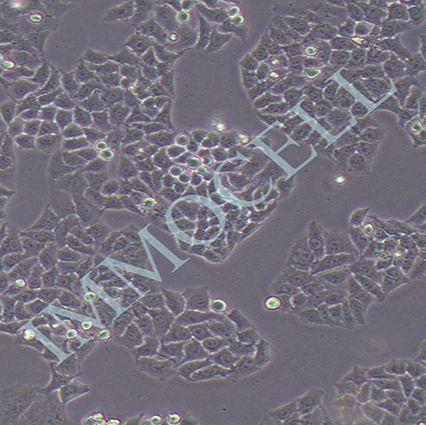 RwPE-2(人前列腺正常细胞)丨RwPE-2细胞株(STR鉴定)