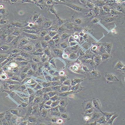 QGY7701 人肝癌细胞丨QGY-7701细胞株
