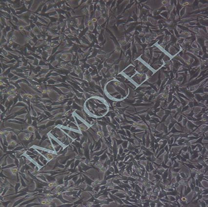 RM-1小鼠前列腺癌细胞丨RM-1细胞株(immocell)