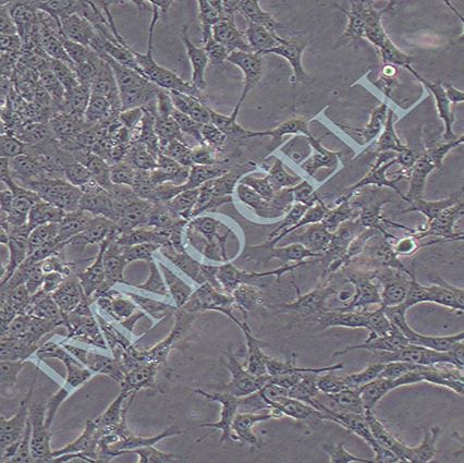 MB49小鼠膀胱癌细胞 报价丨mb49细胞丨逸漠(immocell)