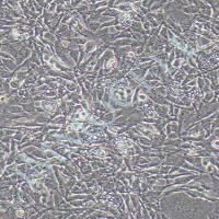 TM4正常小鼠睾丸Sertoli细胞丨tm4细胞丨TM4