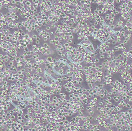 Kasumi-1 人急性髓母白血病细胞