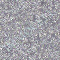 Kasumi-1 人急性髓母白血病细胞