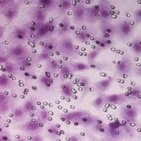 transwell细胞迁移实验