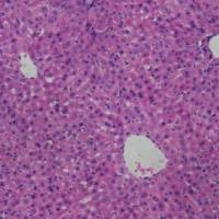 肝组织HE检测实验