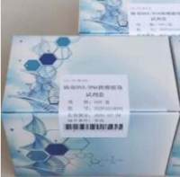 人乳腺癌易感蛋白1(BRCA-1)PCR试剂盒