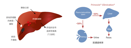 普美显在肝脏肿瘤筛查和定性诊断中的应用 420.png