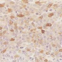 细胞免疫组化技术服务