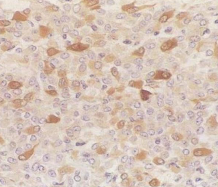 细胞免疫组化技术服务