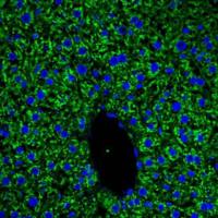 激光共聚焦检测