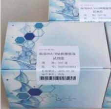 人基质金属蛋白酶抑制因子2(TIMP-2)PCR试剂盒