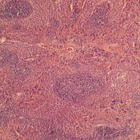 脾组织HE检测服务