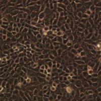 CAL-27人舌鳞癌细胞实验