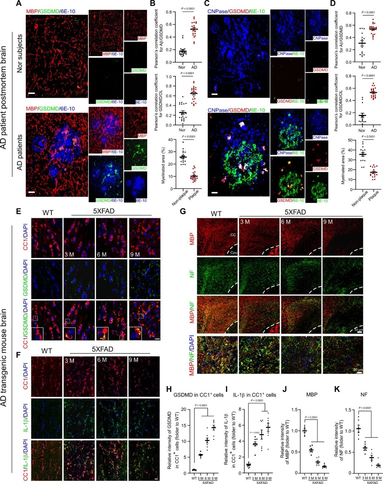 阿尔茨海默症新靶点通路——Drp1-HK1-NLRP3