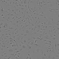 6-10B细胞人鼻咽癌细胞实验