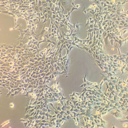 293T人胚肾细胞实验