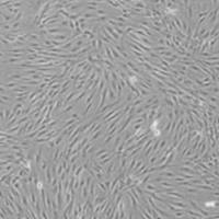 EC109人食管癌细胞实验