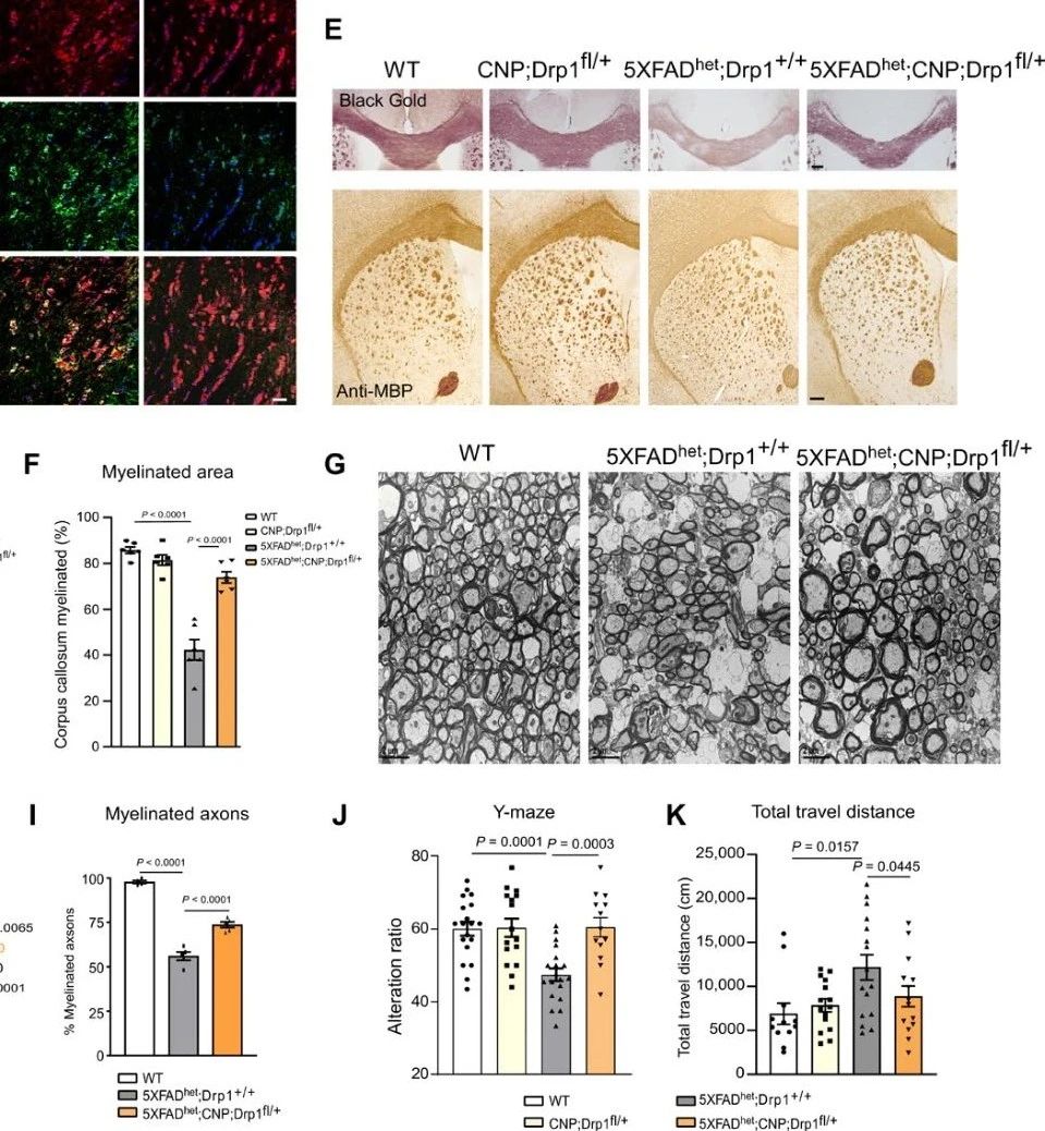阿尔茨海默症新靶点通路——Drp1-HK1-NLRP3