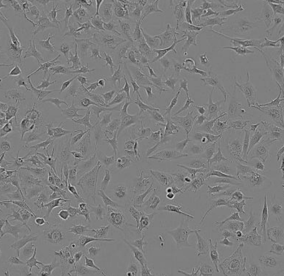 6-10B细胞人鼻咽癌细胞实验