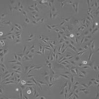 SW 780人膀胱移行细胞癌实验