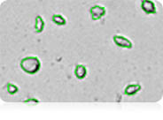 Irregular-shaped Cell image from Cellometer Auto T4