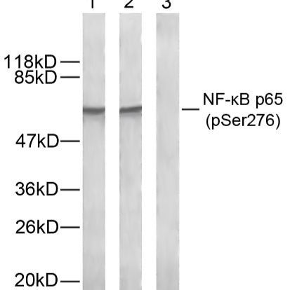 NFκB-p65(Phospho-Ser276) Antibody产品图