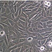 人大肠癌细胞实验