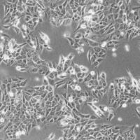 人低转移肝癌细胞实验