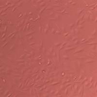 人脑星形胶质母细胞瘤细胞实验