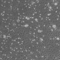 细胞成脂诱导实验