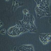 SW 982人滑膜肉瘤细胞实验