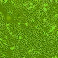 CT26.WT小鼠结肠癌细胞实验